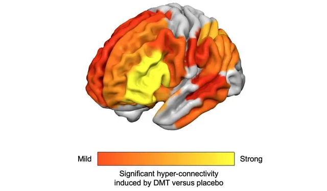  Los efectos de la DMT en el cerebro se compararon con el consumo de placebo. Imagen: Imperial College London    