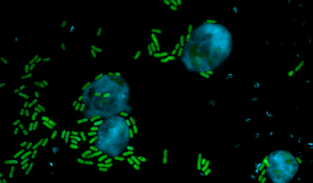 La bacteria Pseudomona resulta ser tóxica para el virus amoeba. Foto: Harikumar Suma/Leibniz-HKI    