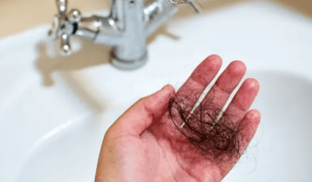 La caída de cabello puede ser por falta de hierro, estrés u otras afecciones. Foto: AFP   