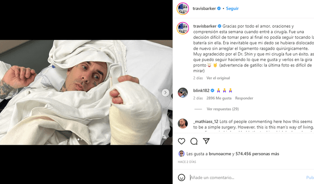  Travis Barker se muestra en redes tras ser operado. Foto: captura/ Instagram 