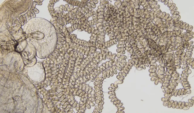El extremo espermatozoide de la mosca de la fruta bajo microscopio. Foto: Scott Picnick El extremo espermatozoide de la mosca de la fruta bajo microscopio. Foto: Scott Picnick