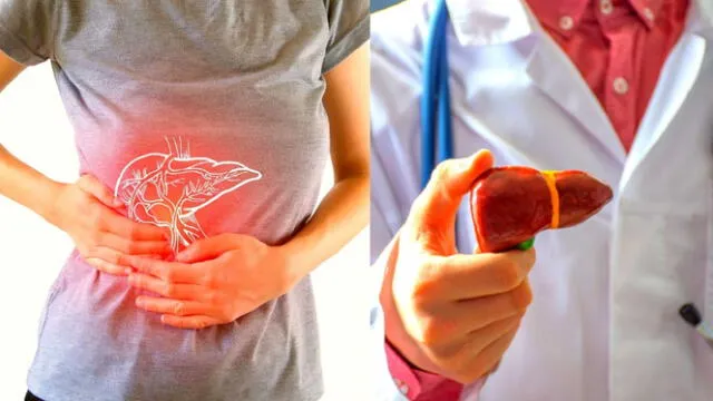 Si sospechas de los síntomas del cáncer de hígado, lo mejor es acudir a tu médico para que descarte esta enfermedad. Foto: composición LR/Shutterstock/difusión 