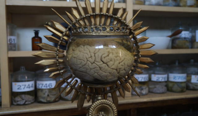  El Museo del Cerebro fue inaugurado con fines educativos. Foto: difusión   