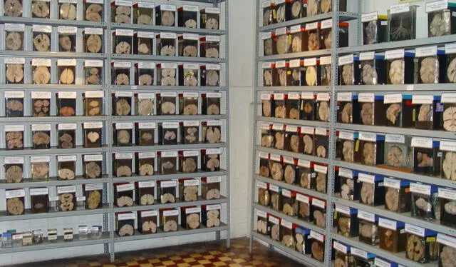 Museo Del Cerebro 2023 En Lima ¿cómo Llegar Y Dónde Queda Revisa La Dirección Horarios Y Más 8164