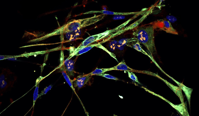  La nueva terapia convierte las células cancerosas en unas musculares típicas. Foto: Laboratorio Cold Spring Harbor   