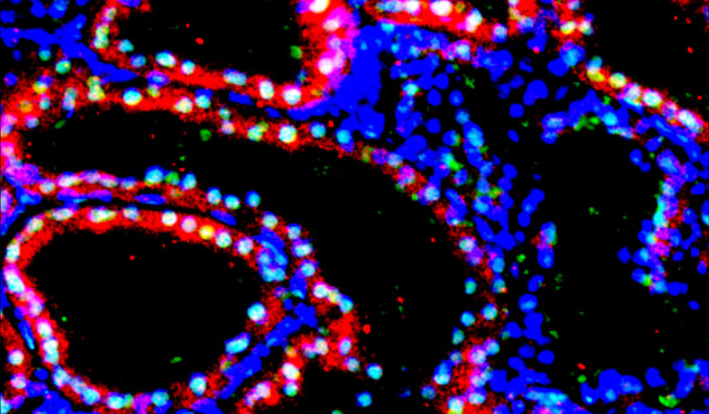  El riñón humano cultivado en un embrión de cerdo estaba compuesto por entre un 50% y 60% de células humanas (algunas se ven aquí en rojo). Foto: Cell (2023)   