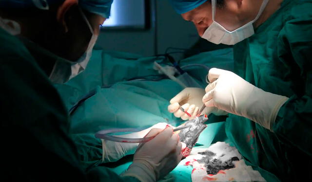 Los médicos del hospital Xiangya consideraron que lo mejor era unir la mano del joven a su pie para que no perdiera la circulación. Foto: The Guardian   