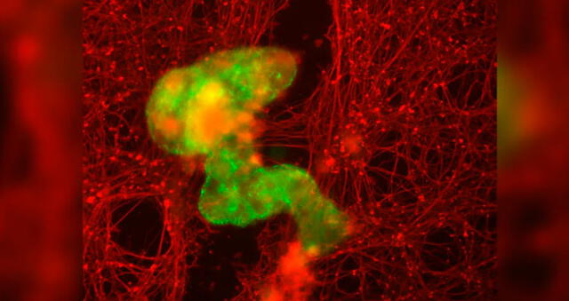  Un antropobot, señalado en verde, crece en medio de un rasguño en las neuronas. Foto: Gizem Gumuskaya / Universidad de Tufts 