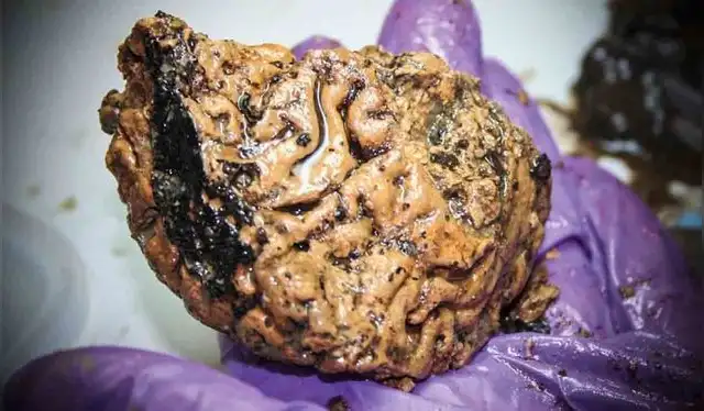 El cerebro de Heslington le habría pertenecido a un hombre entre 26 y 45 años de edad. Foto: York Archaelogical Trust El cerebro de Heslington le habría pertenecido a un hombre entre 26 y 45 años de edad. Foto: York Archaelogical Trust
