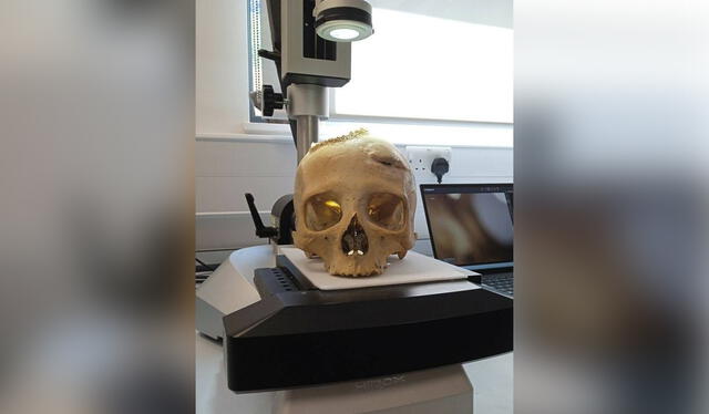 La investigación incluye al cráneo E270, que pertenecía a una mujer que también tenía un tumor en el cerebro. Foto: Tondini, Isidro, Camarós   