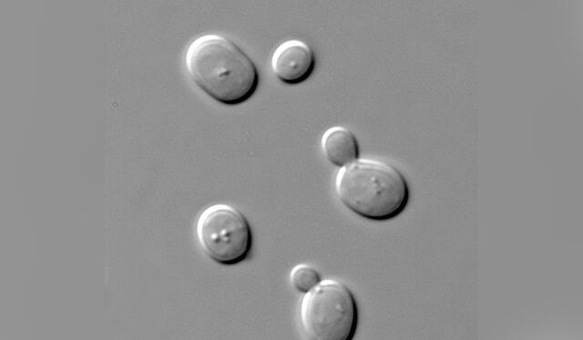 Imagen por microscopio del hongo Saccharomyces cerevisiae. Foto: Wikimedia Commons 