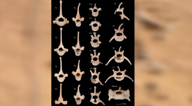  El análisis osteológico evidenció que parte de las vértebras dorsales, todas las lumbares y el sacro tenían deformaciones . Foto: Conicet    