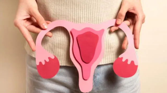 Los síntomas del cáncer de ovario incluyen cambios en el ciclo menstrual y dolor pélvico anormal. Foto: difusión   