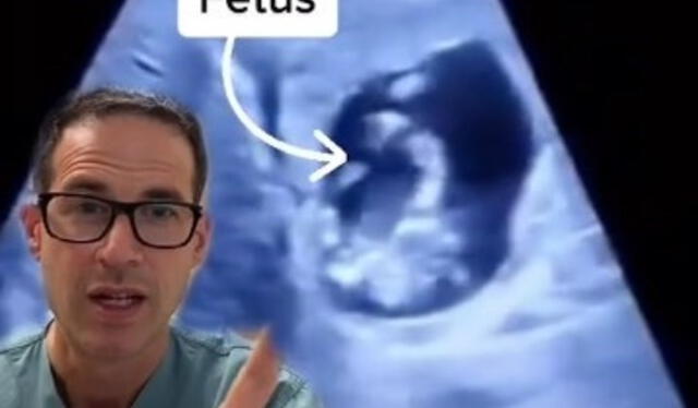 El médico hizo un video viral a través de redes sociales, explicando el caso. Foto: Tik Tok   