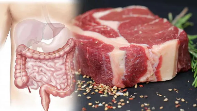  Estudios científicos reiteran conexión entre el consumo de carnes rojas y el cáncer colorrectal. Foto: Noticias RCN.    