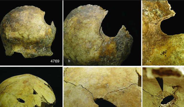  Los expertos analizaron más de 3.000 huesos humanos y fragmentos del yacimiento de la Edad del Bronce de Charterhouse Warren. Foto: La Vanguardia   