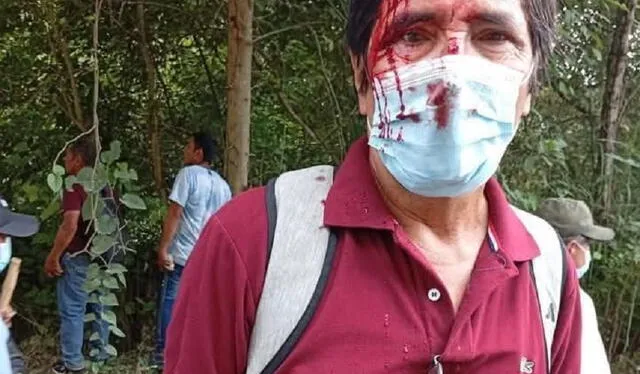Rondero herido en enfrentamiento con mineros informales en San Ignacio, en Cajamarca Rondero herido en enfrentamiento con mineros informales en San Ignacio, en Cajamarca