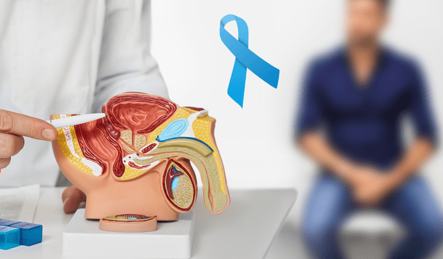  El Día Mundial del Cáncer de Próstata es el 11 de junio. Foto: Composición LR<br>   