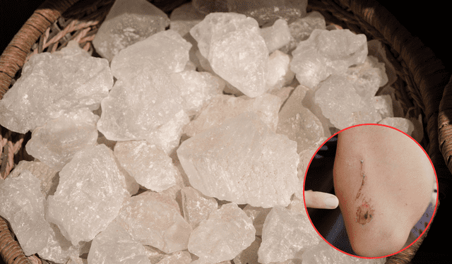 El alumbre puede ser usado para tratar heridas. Foto: Composición LR<br><br> El alumbre puede ser usado para tratar heridas. Foto: Composición LR<br><br>