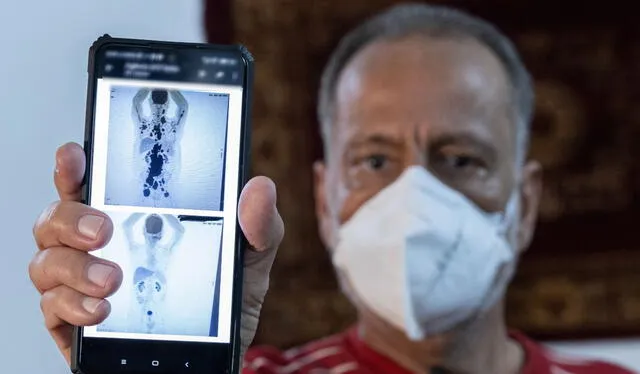 Paulo Peregrino mostrando los resultados de tomografía luego de su tratamiento de células CAR-T. Fuente: Difusión. Paulo Peregrino mostrando los resultados de tomografía luego de su tratamiento de células CAR-T. Fuente: Difusión.