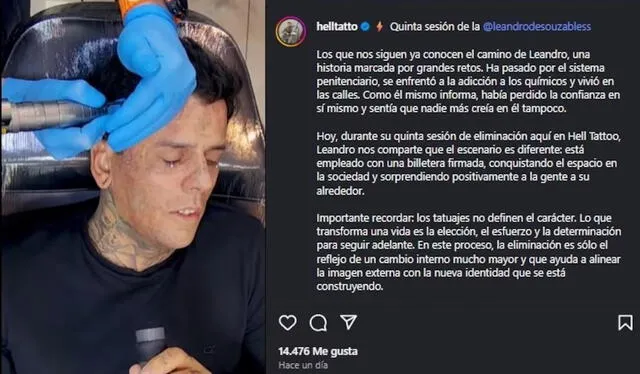  Leandro de Souza publicando en su cuenta personal de Instagram de cómo pasó su quinta sesión de cirugía láser. Foto: IG - Leandro de Souza   