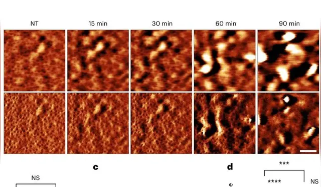  Las imágenes muestran que la red de porinas en E. coli en fase estacionaria permanece intacta hasta 60 minutos tras la exposición a polimixina B. Foto: Nature   