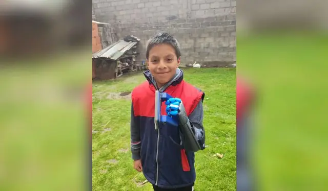 Caso. Benjamín no tenía mano, pero ya puede agarrar las cosas con una prótesis.   