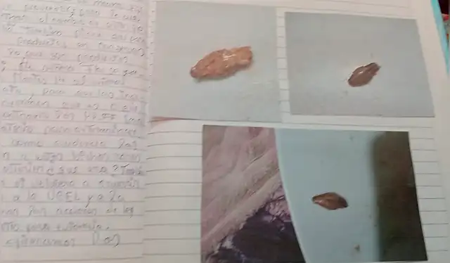  Padres de familia y docentes expresaron su preocupación por la desaparición repentina del 'bicho'. Foto: Cinthia Alvarez / La República.<br><br>    