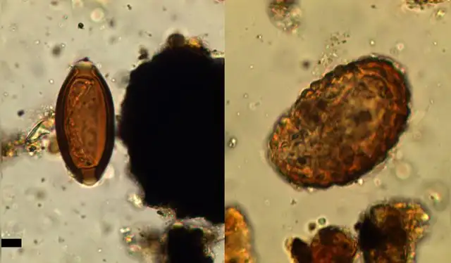  Huevos de Trichuris sp. (izquierda) y Ascaris sp. (derecha) recuperados de Vindolanda. Foto: Parasitology   
