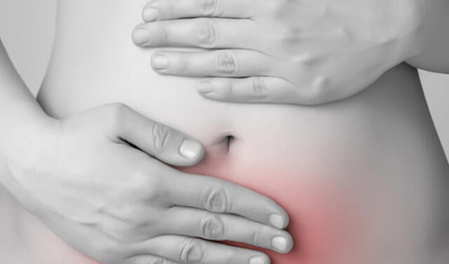 En pacientes entre 45-50 años, la propuesta es eliminar ambos ovarios para evitar la degeneración maligna. Foto: Matronas.org