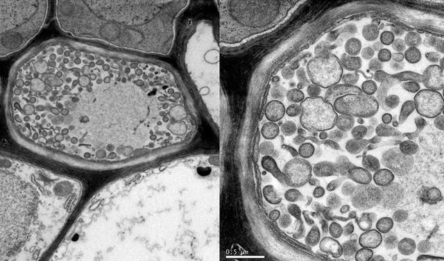 Fitoplasmas en células vegetales. Imagen: Munhoz et al/ Plant Pathology