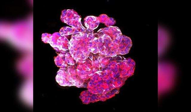 Se utilizaron organoides mamarios con el objetivo de probar sus respuestas a nuevos medicamento contra el cáncer de mama | Foto: Kelvin Yip - Monash Mico Imaging (MMI)