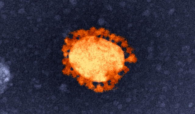 La supervivencia del coronavirus en superficies comunes depende de la temperatura | Foto: CSIRO