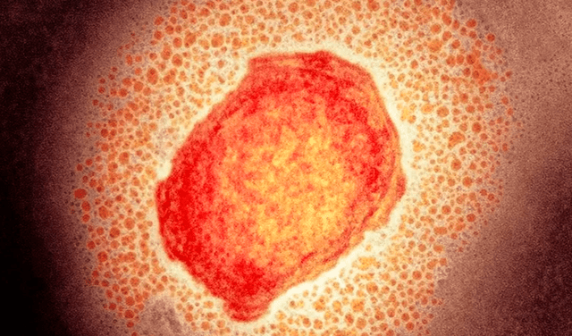 Una partícula del virus de la viruela de los monos en el microscopio. Foto: Science Photo Library