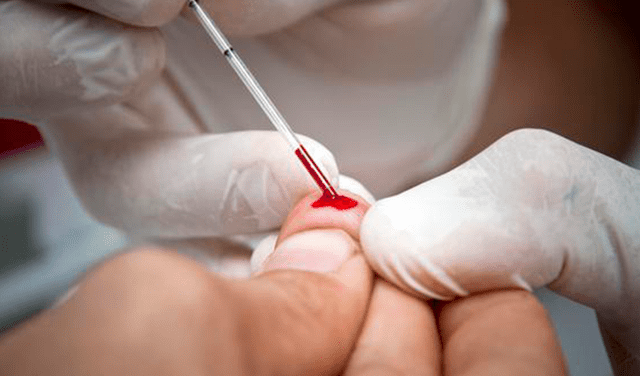 Transmisión del VIH vía sanguínea