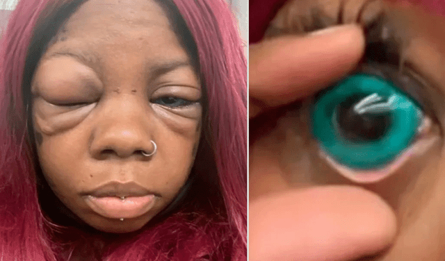 Mujer se tatuó los ojos de colores y ahora está a punto de quedarse ciega: “Fue traumático”