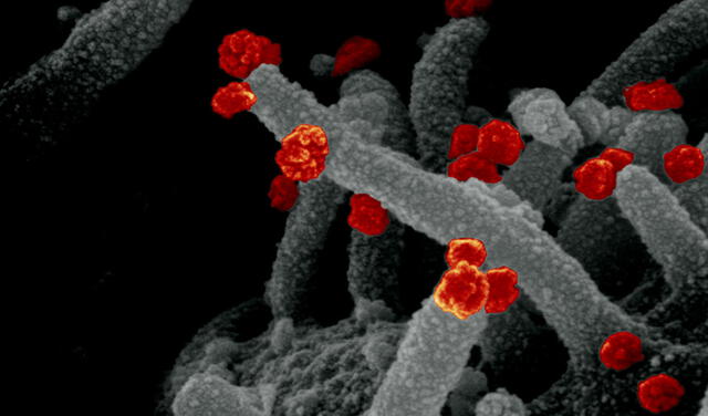 La nueva variante del coronavirus tiene 50 mutaciones, de las cuales 32 alteran sus espículas. Foto: partículas de SARS-CoV-2 salen de una célula infectada / NIAID