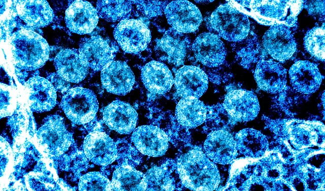 Microfotografía de partículas del coronavirus SARS-CoV-2 aisladas en laboratorio. Foto: NIAID.