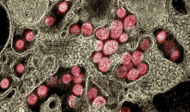 Partículas del coronavirus SARS-CoV-2 invadiendo el tejido celular en el pulmón de un paciente. Imagen: NIAID.
