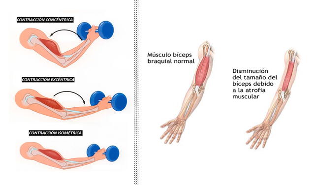 A la izquierda, tipos de contracciones; a la derecha, un ejemplo de atrofia muscular por inmovilidad | Foto: Composición LR / ADAM Health Solutions / Fisiocampus