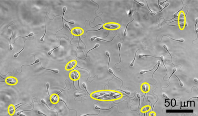 Los espermatozoides agrupados están señalados dentro de un óvalo amarillo. Foto: S. Phuyal / S. Suárez / CK Tung.