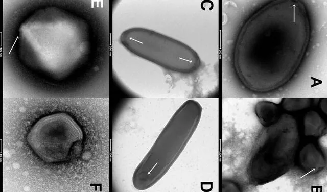 Algunos de los virus aislados del permafrost siberiano. El "A" es el pandoravirus más antiguo. Foto: Alempic et al