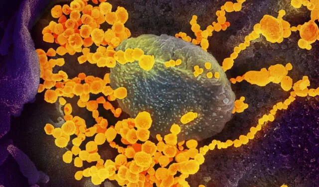 Un cultivo de laboratorio donde el SARS-CoV-2 se muestra en amarillo escapando de células | Fotocaptura: Handout / AFP