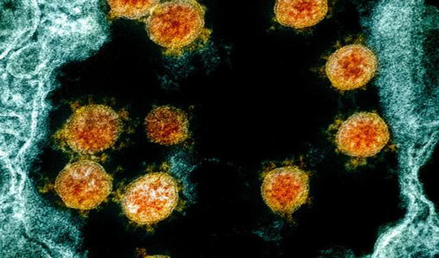 El coronavirus SARS-CoV-2 (en naranja) dentro de un paciente en microfotografía electrónica | Foto: Instituto Nacional de Alergias y Enfermedades Infecciosas (NIAID)