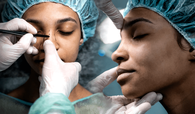 La cirugía plástica más solicitadas por los millennials es la rinoplastia
