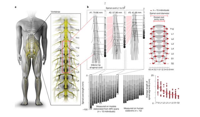 Los electrodos insertados en la médula estimulan los nervios de las extremidades inferiores. Imagen: Rowald et al.