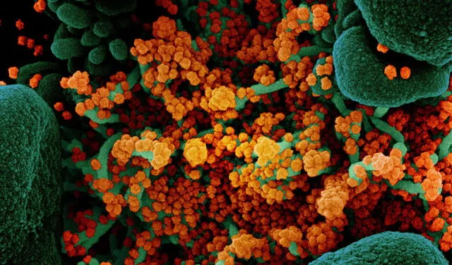 Imagen captada con microscopio electrónico muestra miles de partículas de SARS-CoV-2 saliendo de una célula infectada. Foto: NIAID