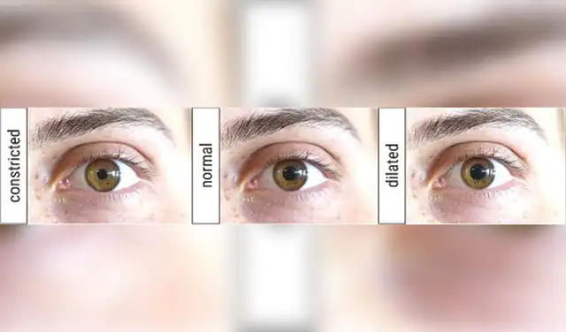 Los ojos de DW en diferentes estados de dilatación. Fotos: Eberhardt et al