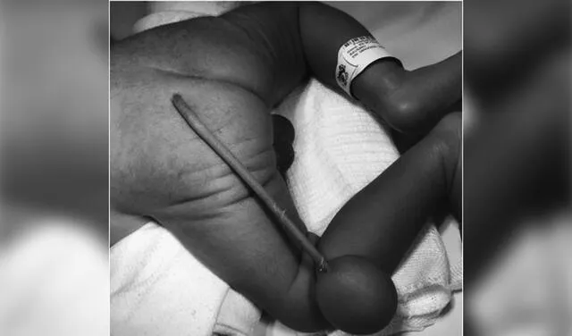 La cola del bebé sostenía un apéndice esférico. Foto: Forte et al.