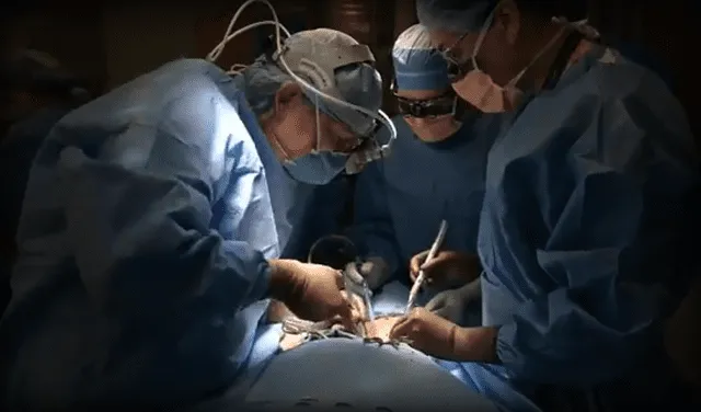 El equipo de Robert Montgomery, en pleno trasplante del riñón de cerdo. Foto: captura de video/Usa Today